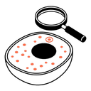 Spot & Foci Detection