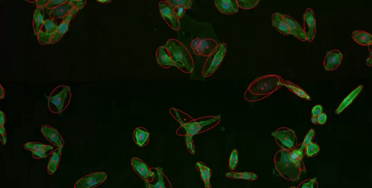 Your Microscope, Enhanced by Cytely